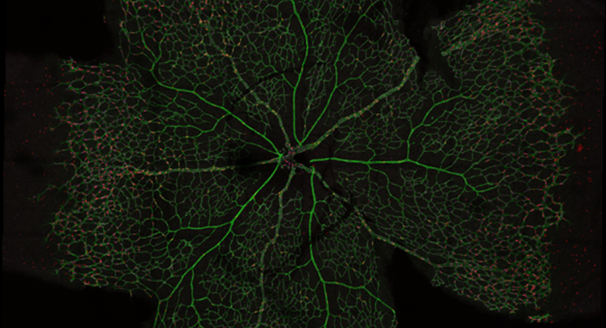 Example of bioimage analysis of the retina