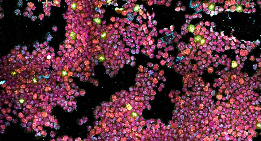 Lung stem cells undergoing replication