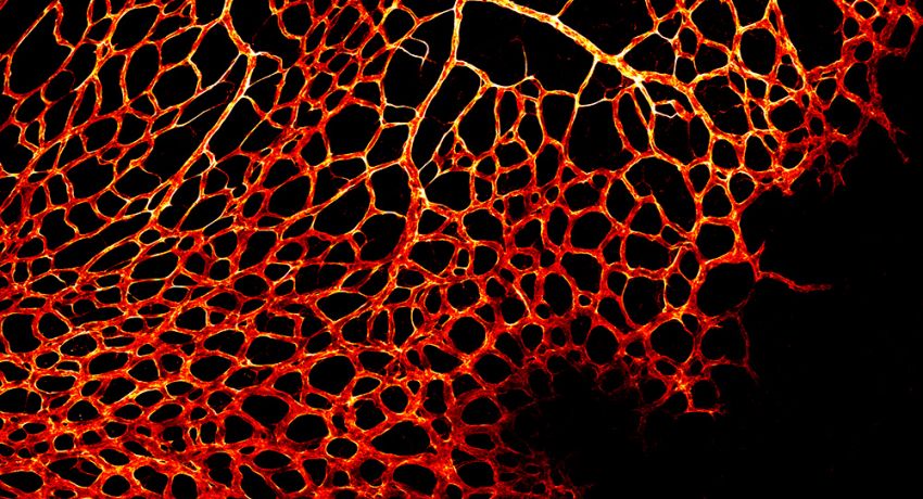 Blood vessels at the edge of the retina
