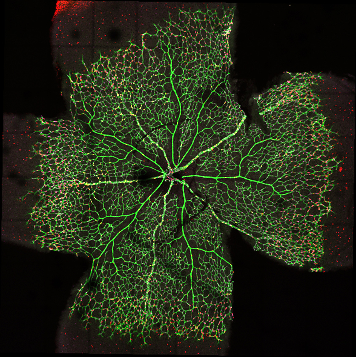 A quantitative look at cell death in the vasculature | Centre for ...
