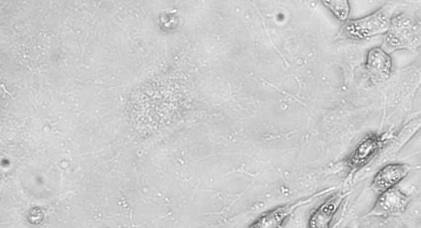 Snapshot of fat cells