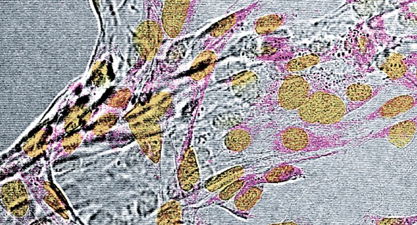 Microscopy image of myoblast cells