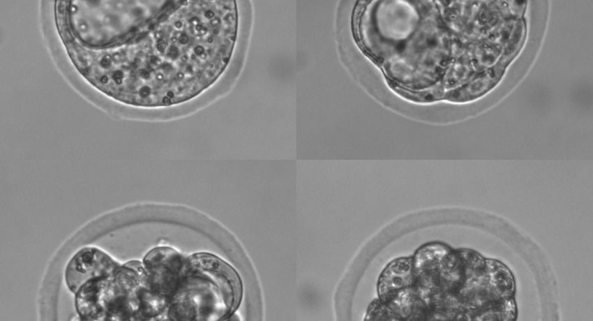 Four images of cells in a dish
