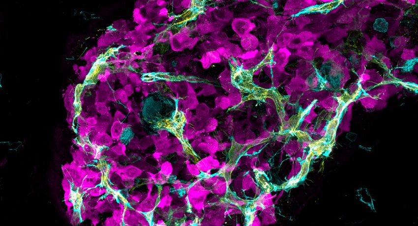 High resolution 3D imaging of tumour cells
