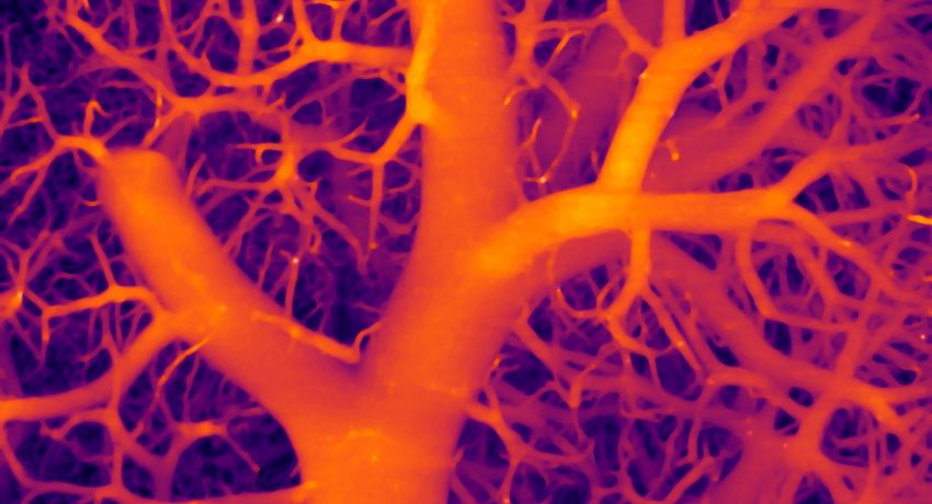 A blood vessel network in lung tissue appears as a tree-like structure is shown in orange against a pink and dark background